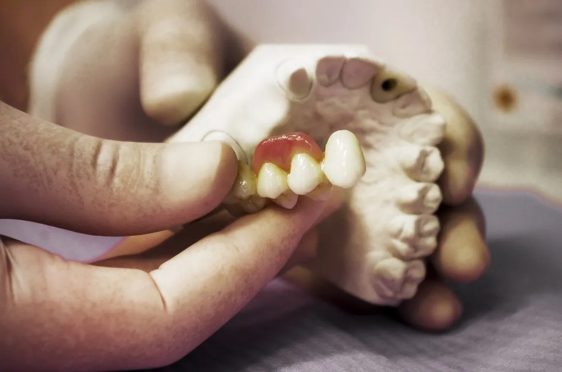 Le mani di un odontotecnico che rifiniscono una protesi dentale su un modello in gesso